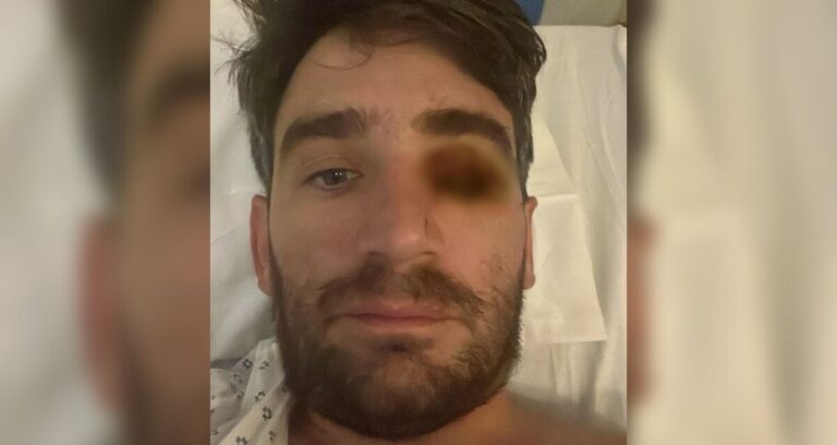 Trágico accidente en fiesta de Año Nuevo: Hombre pierde el ojo por explosión de fuego pirotécnico