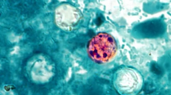 Investigan brote de ciclospora vinculado a cafetería de hospital en New Hampshire